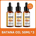 Huile de Batana croissance rapide – Soin naturel cheveux