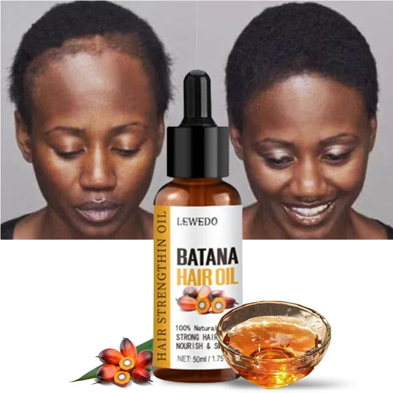 Huile de Batana croissance rapide – Soin naturel cheveux